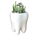 Molar Plant Pot - Tooth Shaped Vase - TOOTHLET